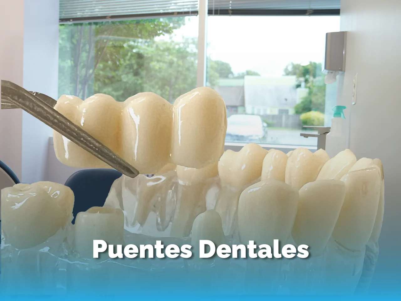 Puente Dental - Top Dental