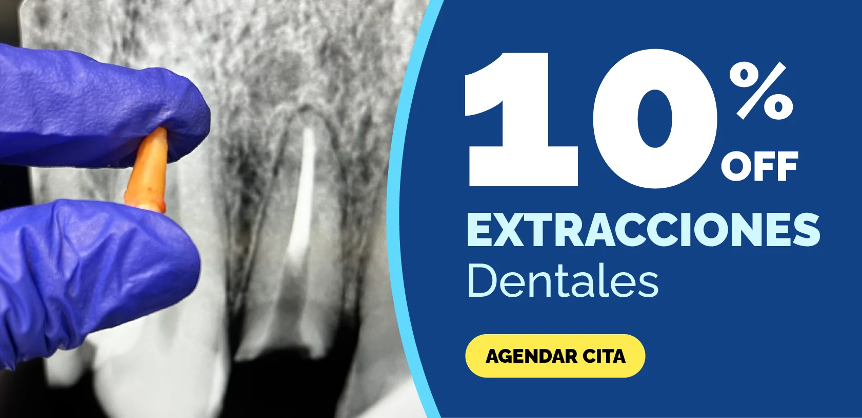 Dental extraction promotion at Top Dental