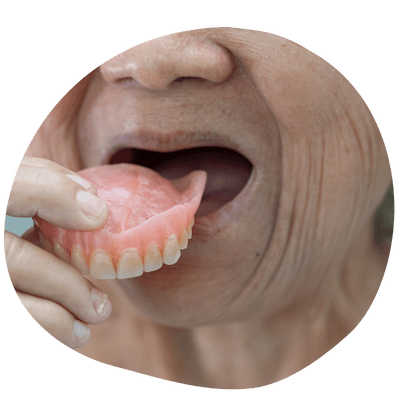 Dentadura removible personalizada en Top Dental