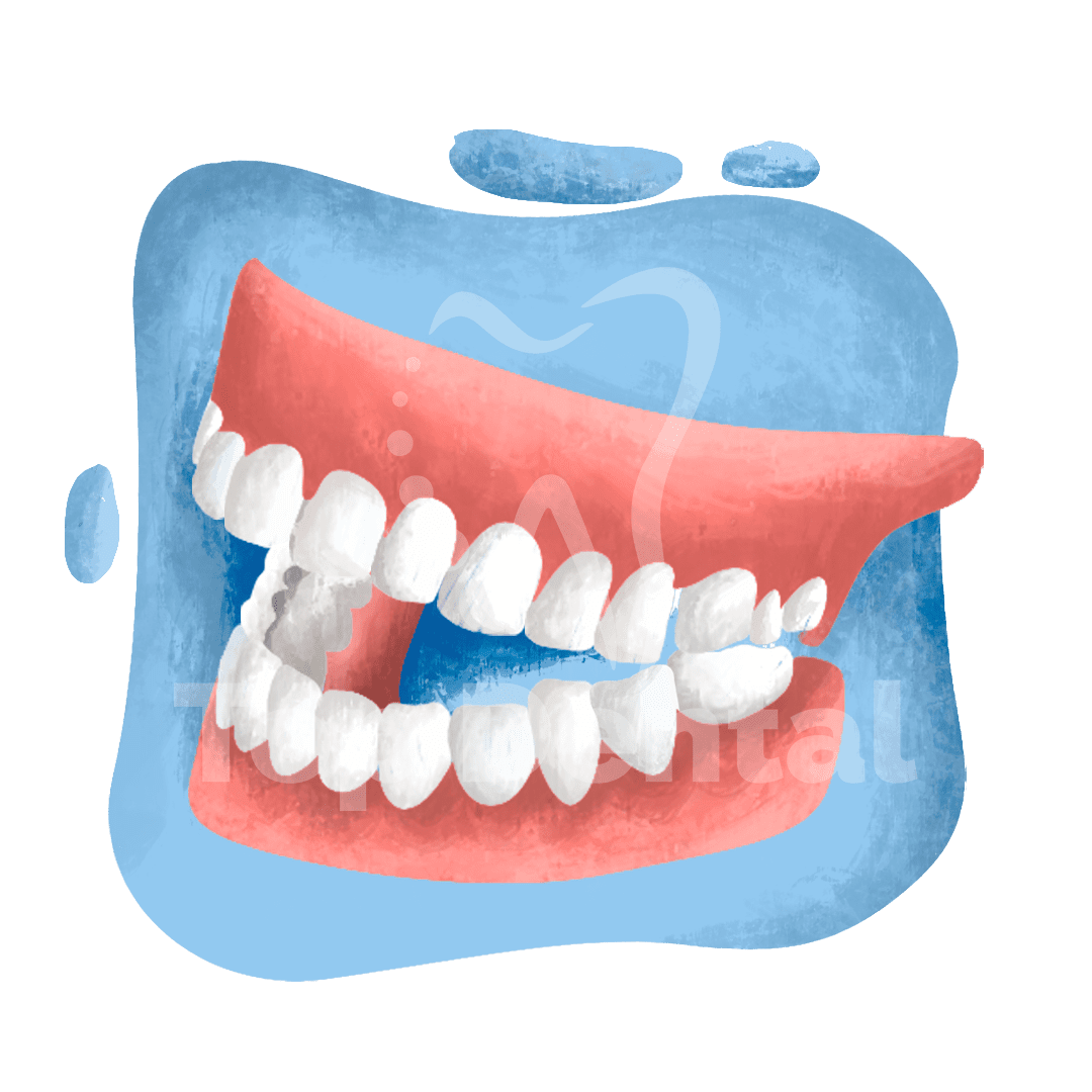 Dentaduras Top Dental