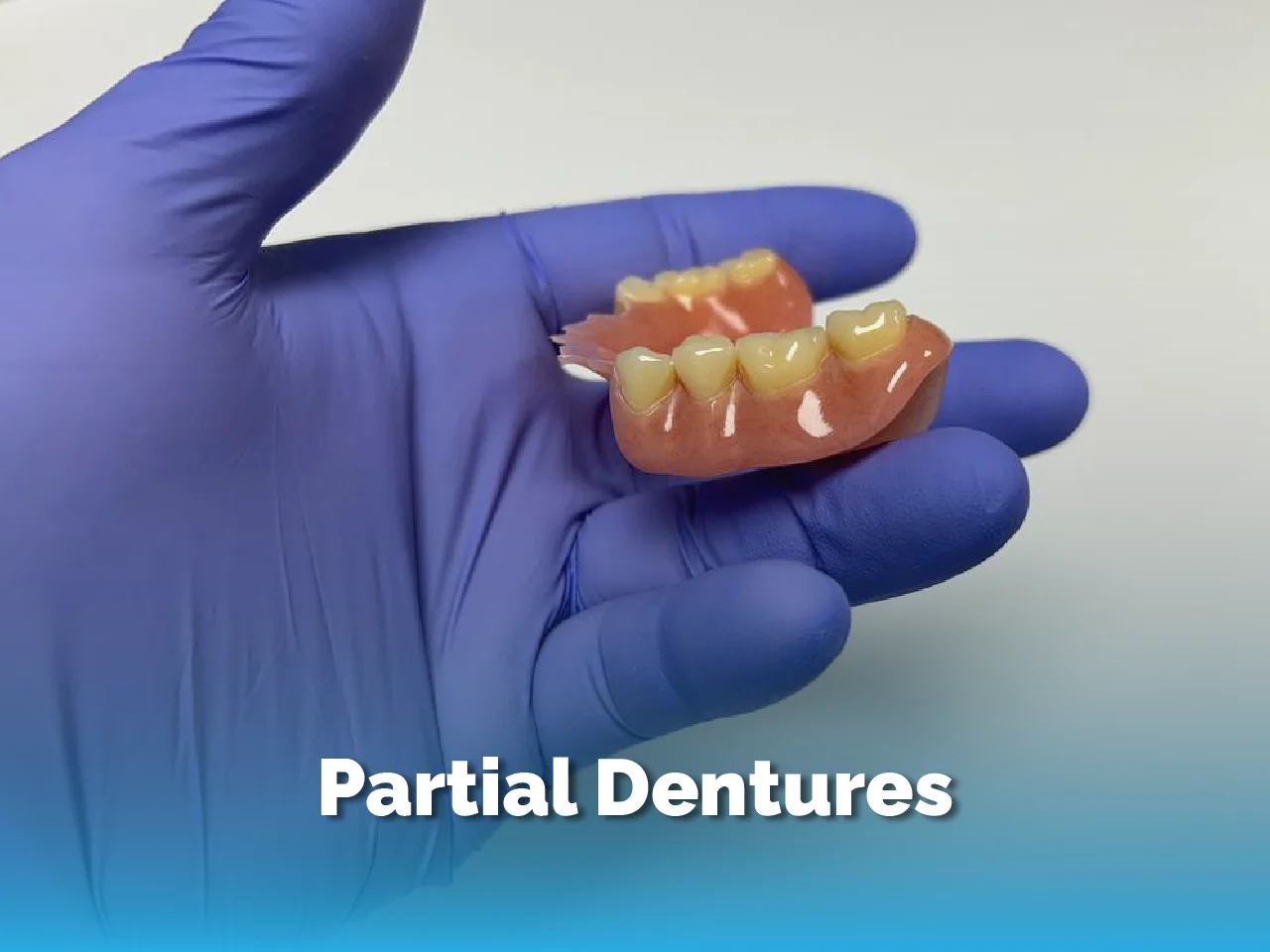 Partial Denture - Top Dental