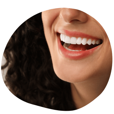 Smiling Patient with Dental Crown at Top Dental