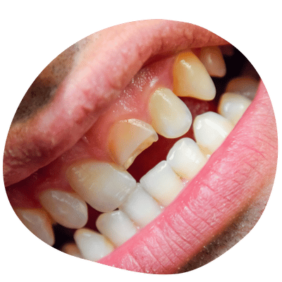 Emergency Dental Care at Top Dental