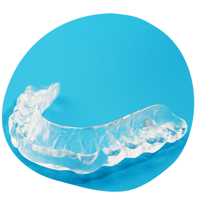 Custom Dental Guards at Top Dental – Protection and Comfort