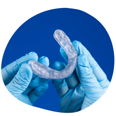 Custom Occlusal Guard at Top Dental