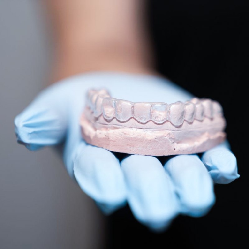 Clear aligners at Top Dental
