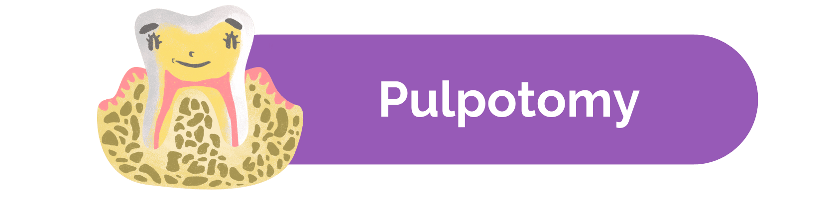 Pulpotomy